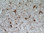 FBXO2 Antibody in Immunohistochemistry (Paraffin) (IHC (P))