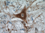 FBXO2 Antibody in Immunohistochemistry (Paraffin) (IHC (P))