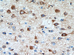 FBXO2 Antibody in Immunohistochemistry (Paraffin) (IHC (P))