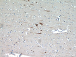 FBXO2 Antibody in Immunohistochemistry (Paraffin) (IHC (P))