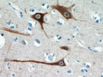 FBXO2 Antibody in Immunohistochemistry (Paraffin) (IHC (P))