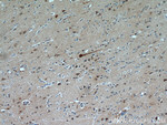 FBXO2 Antibody in Immunohistochemistry (Paraffin) (IHC (P))