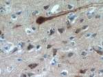 FBXO2 Antibody in Immunohistochemistry (Paraffin) (IHC (P))