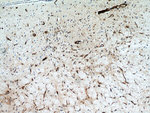 FBXO2 Antibody in Immunohistochemistry (Paraffin) (IHC (P))