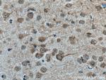 FBXO2 Antibody in Immunohistochemistry (Paraffin) (IHC (P))