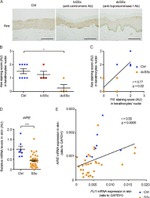 AIRE Antibody in Immunohistochemistry (IHC)