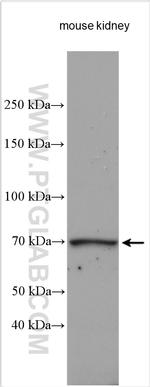 RAB11FIP5 Antibody in Western Blot (WB)