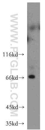 RAB11FIP5 Antibody in Western Blot (WB)