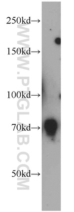 RAB11FIP5 Antibody in Western Blot (WB)