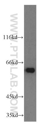 TERF2IP Antibody in Western Blot (WB)