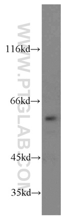 TERF2IP Antibody in Western Blot (WB)