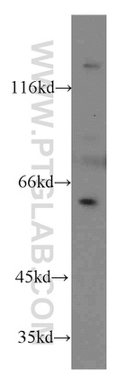 TERF2IP Antibody in Western Blot (WB)