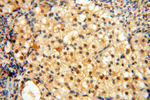 BRN2 Antibody in Immunohistochemistry (Paraffin) (IHC (P))