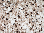 BRN2 Antibody in Immunohistochemistry (Paraffin) (IHC (P))