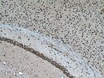 BRN2 Antibody in Immunohistochemistry (Paraffin) (IHC (P))