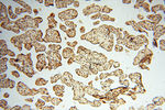 BRN2 Antibody in Immunohistochemistry (Paraffin) (IHC (P))