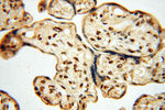 BRN2 Antibody in Immunohistochemistry (Paraffin) (IHC (P))