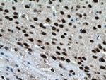 BRN2 Antibody in Immunohistochemistry (Paraffin) (IHC (P))