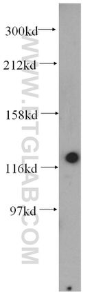 HNRNPU Antibody in Western Blot (WB)