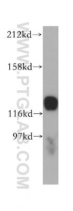 HNRNPU Antibody in Western Blot (WB)