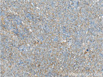 LC3 Antibody in Immunohistochemistry (Paraffin) (IHC (P))