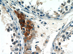 LC3 Antibody in Immunohistochemistry (Paraffin) (IHC (P))