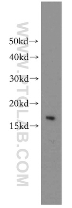 LC3 Antibody in Western Blot (WB)