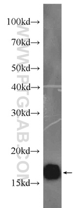 LC3 Antibody in Western Blot (WB)