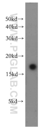 LC3 Antibody in Western Blot (WB)