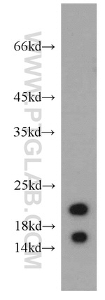 LC3 Antibody in Western Blot (WB)