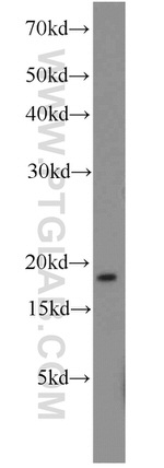 LC3 Antibody in Western Blot (WB)