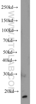 LC3 Antibody in Western Blot (WB)