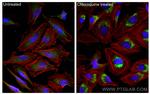 LC3 Antibody in Immunocytochemistry (ICC/IF)