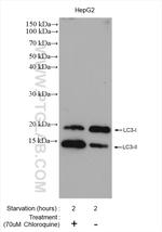 LC3 Antibody in Western Blot (WB)