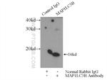 LC3 Antibody in Immunoprecipitation (IP)