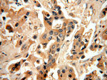 MAGEA6 Antibody in Immunohistochemistry (Paraffin) (IHC (P))