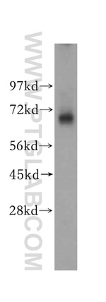 MAGEA6 Antibody in Western Blot (WB)