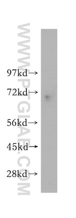 MAGEA6 Antibody in Western Blot (WB)