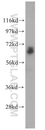 MAGEA6 Antibody in Western Blot (WB)