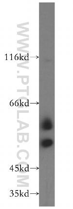 TCP11 Antibody in Western Blot (WB)