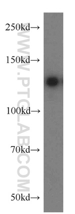 PKN2 Antibody in Western Blot (WB)