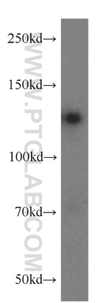 PKN2 Antibody in Western Blot (WB)