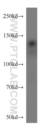 PKN2 Antibody in Western Blot (WB)