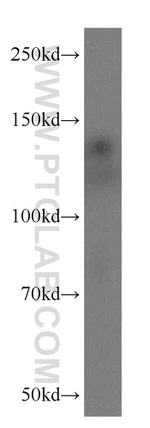 PKN2 Antibody in Western Blot (WB)