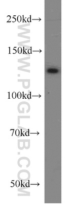 PKN2 Antibody in Western Blot (WB)