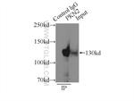 PKN2 Antibody in Immunoprecipitation (IP)