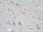 SMPD1/ASM Antibody in Immunohistochemistry (Paraffin) (IHC (P))