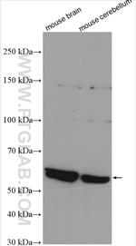 SMPD1/ASM Antibody in Western Blot (WB)