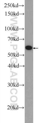 SMPD1/ASM Antibody in Western Blot (WB)