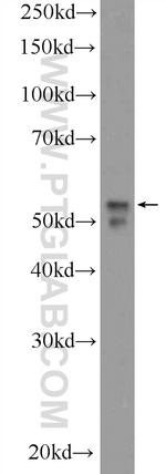 NEUROD4 Antibody in Western Blot (WB)